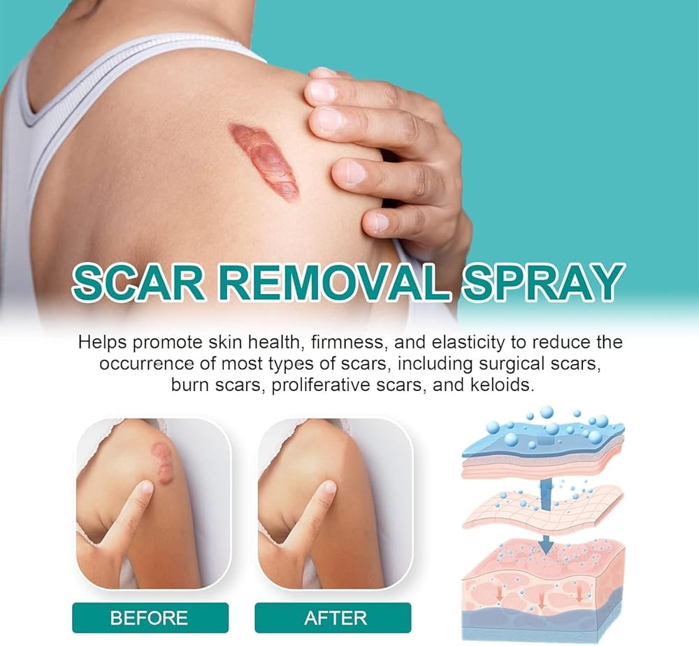 Scar Spray-UAE